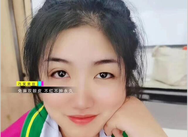 麗竹學(xué)?！凹y繡+雙眼皮”課程開講