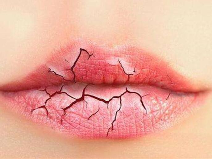 6個(gè)美容技巧，解決秋季嘴唇干燥