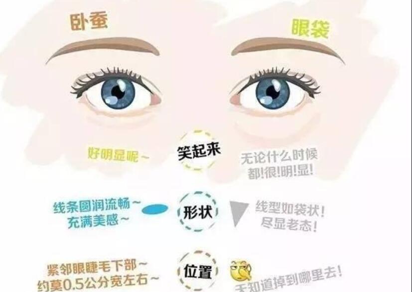 眼袋還是臥蠶，快來學(xué)辨別的方法