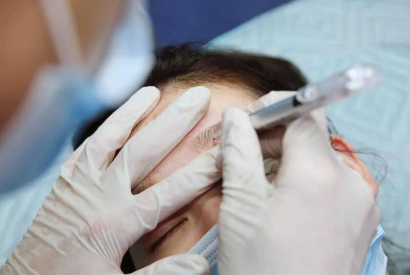 紋繡遇到容易出血的皮膚怎么辦？南寧專業(yè)紋繡培訓(xùn)教你