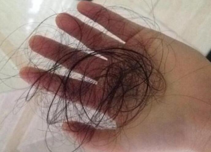 脫發(fā)女孩必備寶典！南寧美發(fā)學校教你