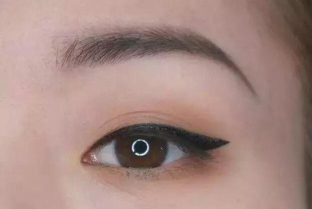 眼尾三角區(qū)怎么處理？