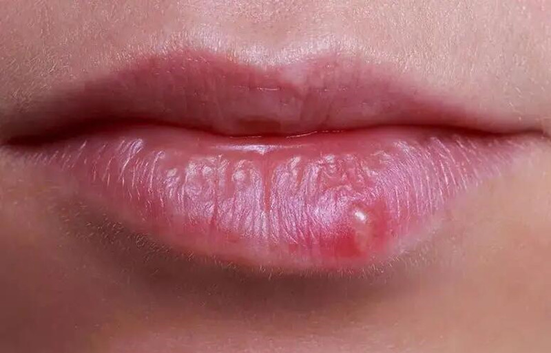 紋唇后起泡怎么辦？南寧紋唇培訓(xùn)學(xué)校教你方法