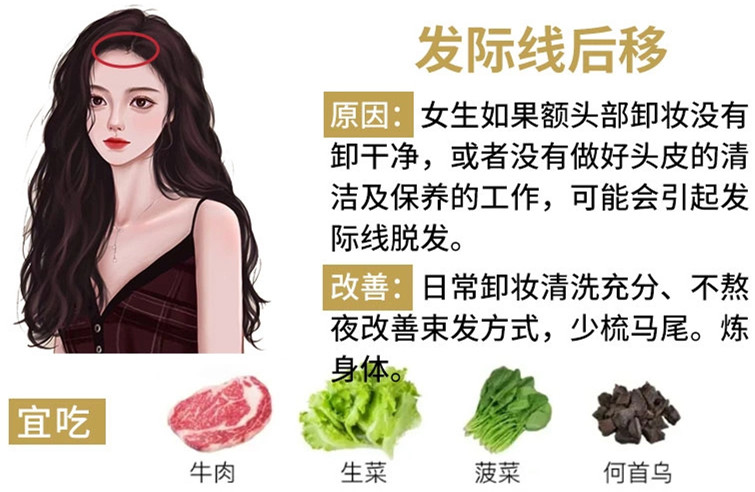如何改善掉頭發(fā)？南寧頭療養(yǎng)發(fā)護發(fā)教學